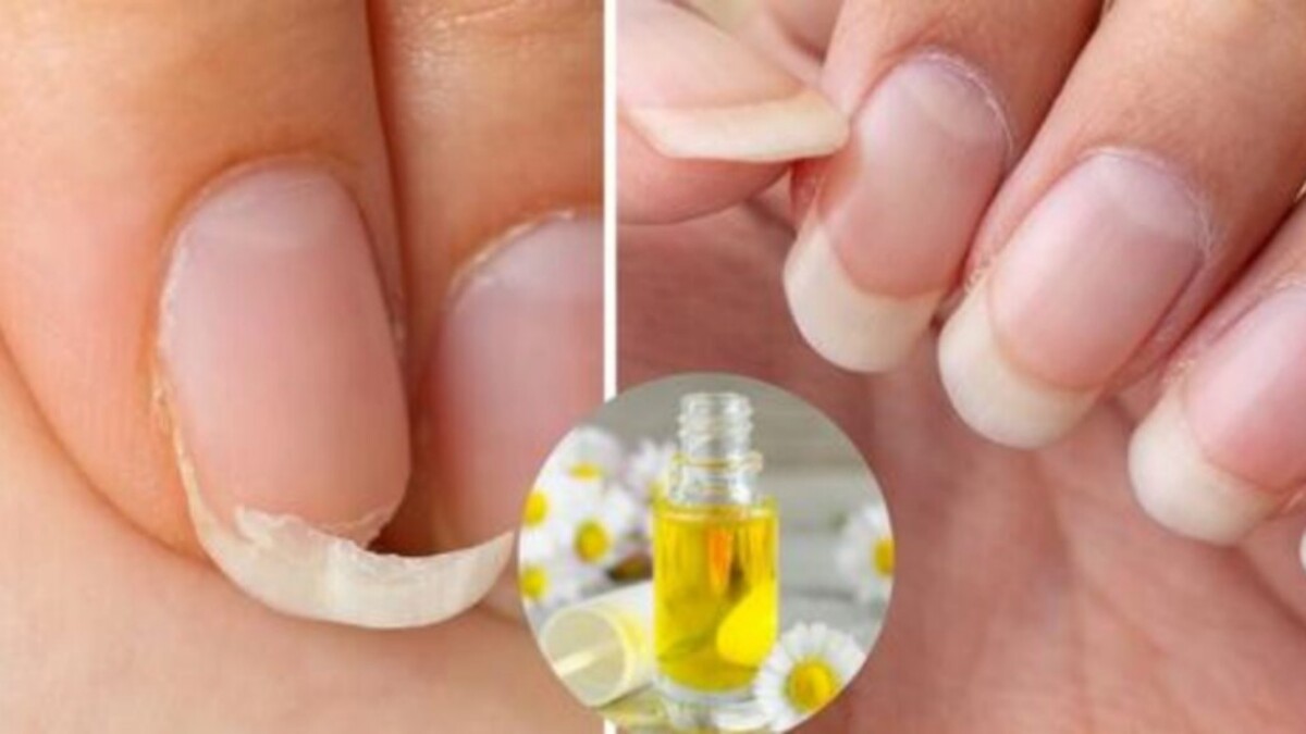 Natural Elements That Promote Faster Nail Growth